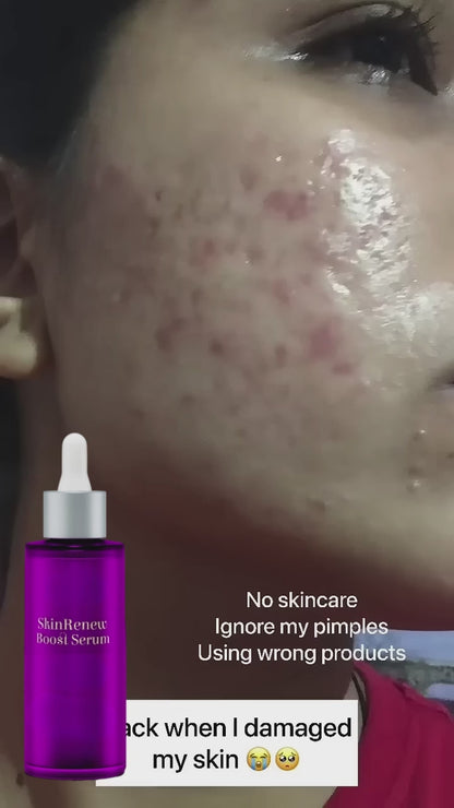 Skin Remove Boot Serum 100ml